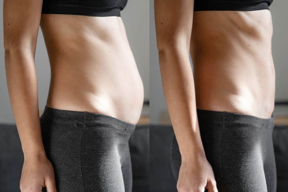 Post-Pregnancy: What Happens to Your Abdominal Muscles After Birth Stanford-le-Hope