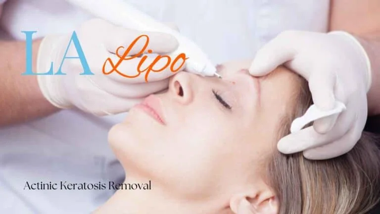 Woman receiving Actinic Keratosis Removal Treatment Stanford-le-Hope