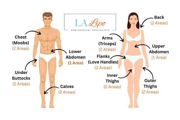 LA LIPO Cryolipolysis Areas Stanford-le-Hope