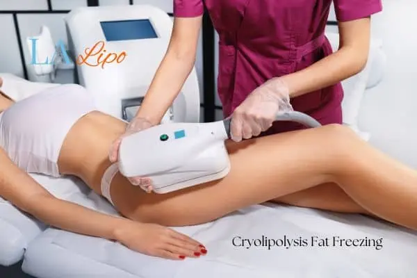 Woman receiving coolsculpting Stanford-le-Hope treatment on her thighs