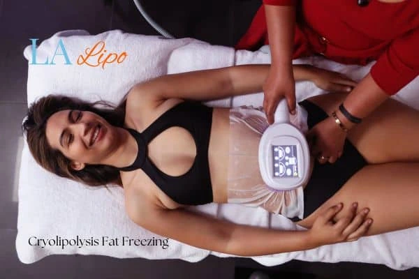 woman getting cryolipolysis Stanford-le-Hope
