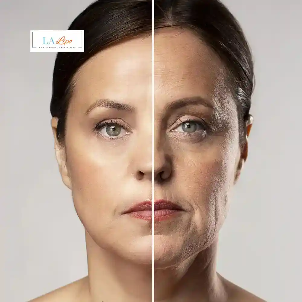 How Can You Tell If Non-Surgical Skin Tightening Is Right for You Stanford-le-Hope?