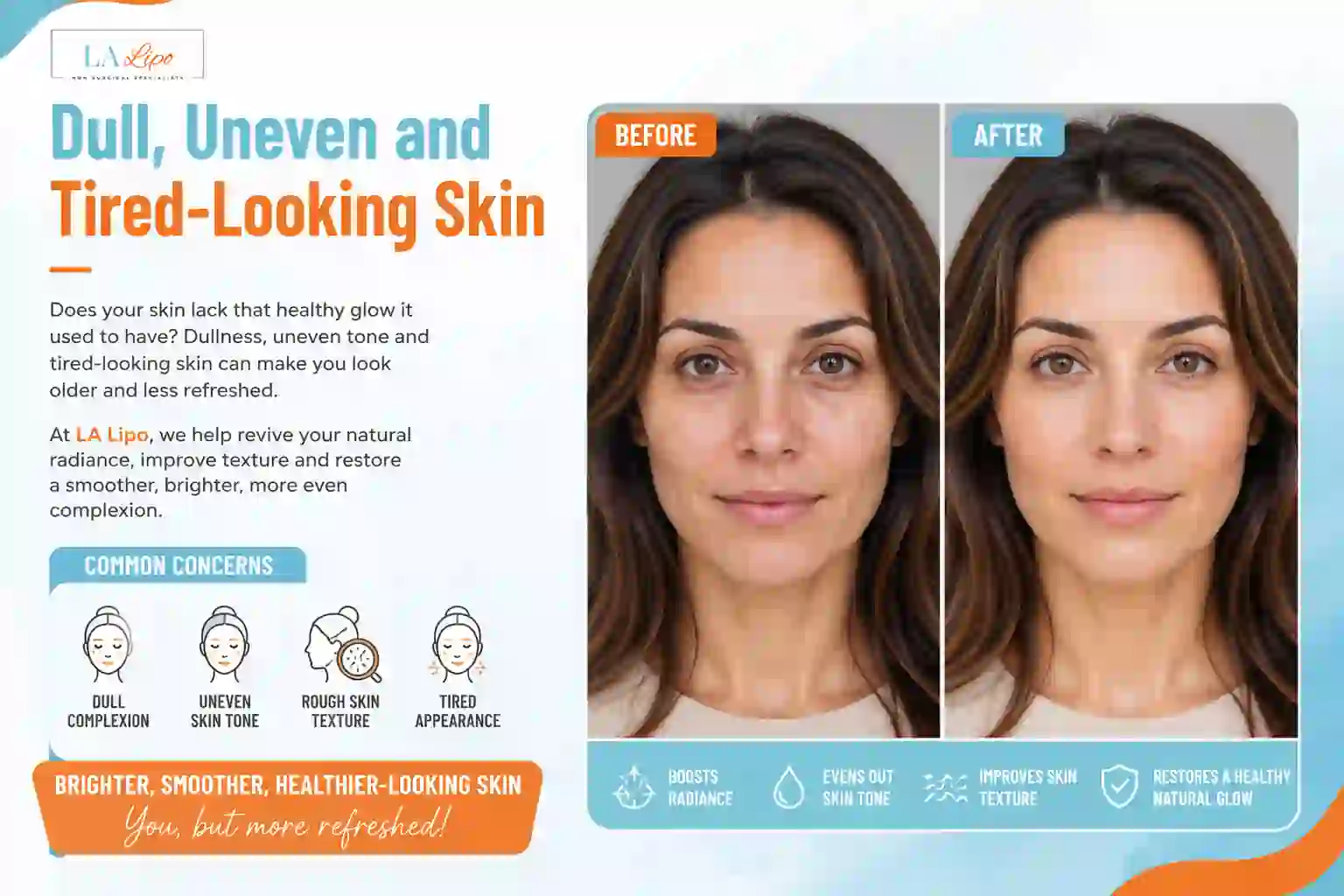 Sign #5: Dull, Uneven and Tired-Looking Skin Stanford-le-Hope