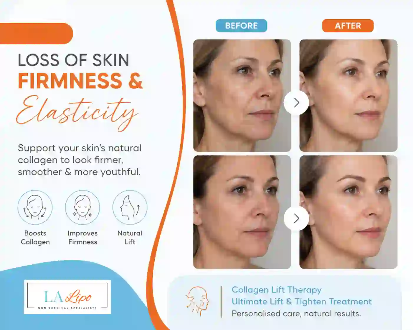 Sign #7: Loss of Skin Firmness and Elasticity Stanford-le-Hope