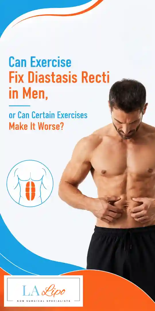 Can Exercise Fix Diastasis Recti in Men, or Can Certain Exercises Make It Worse Stanford-le-Hope?